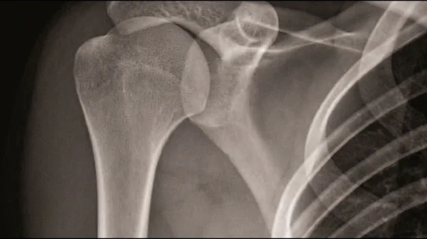 Клинические изображения Цифровой рентгеноcкопический аппарат GE Discovery RF180