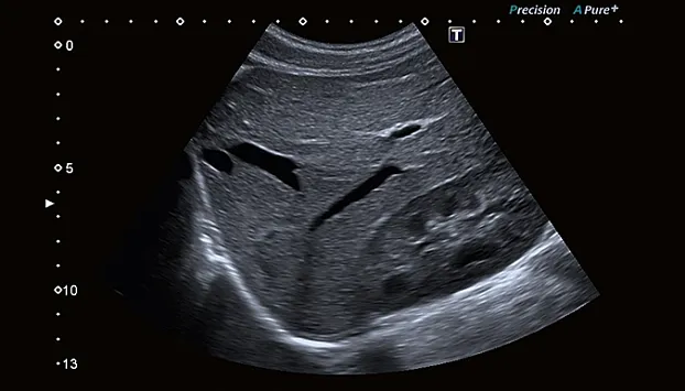 Клинические изображения Canon Xario 100G ультразвуковой аппарат