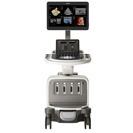 Philips EPIQ Elite ультразвуковой аппарат
