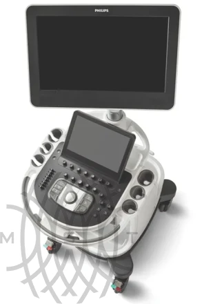 Philips Affiniti 30 ультразвуковой аппарат