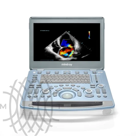 УЗИ аппарат Mindray M8 портативный