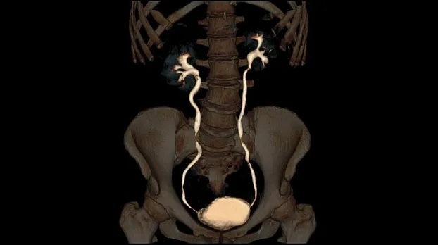Клинические изображения Компьютерный томограф GE Discovery RT
