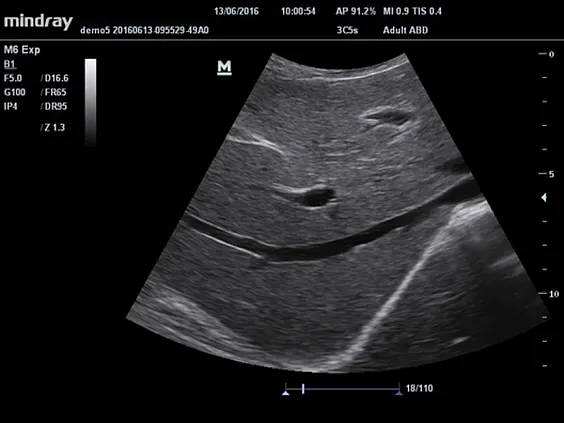 Клинические изображения Mindray M5 New Premium