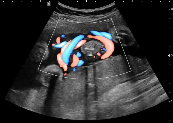 Клинические изображения УЗИ аппарат НПО СКАНЕР РУСКАН 65М