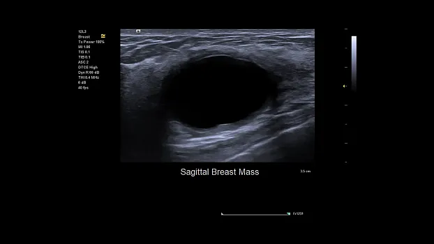 Клинические изображения Siemens Juniper УЗИ аппарат