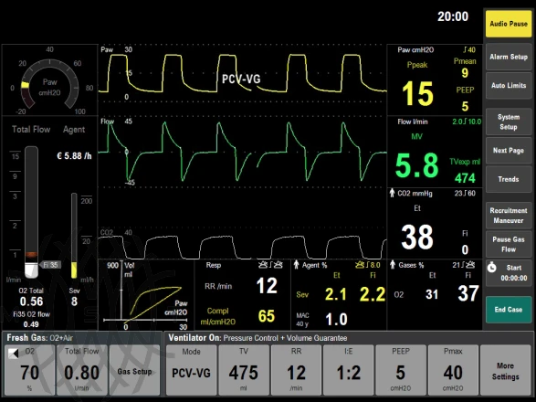 GE Carestation 750 наркозно-дыхательный аппарат