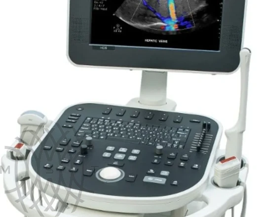 Philips HD5 ультразвуковой аппарат