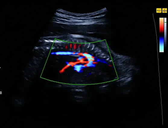 Клинические изображения УЗИ аппарат НПО СКАНЕР РУСКАН 70П портативный