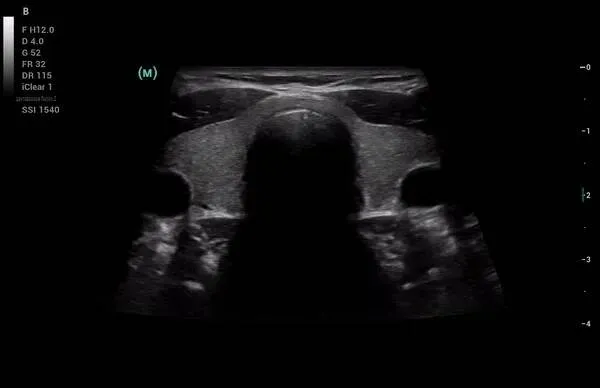 Клинические изображения УЗИ аппарат Mindray Consona N8