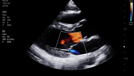 Клинические изображения GE HealthCare Venue Go УЗИ аппарат портативный