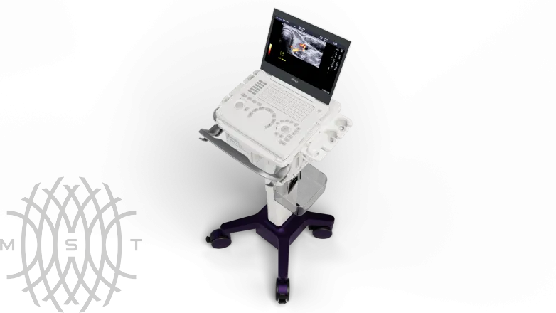 Портативная ультразвуковая система GE HealthCare Logiq e
