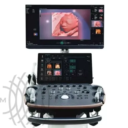УЗИ аппарат Mindray Imagyn I9