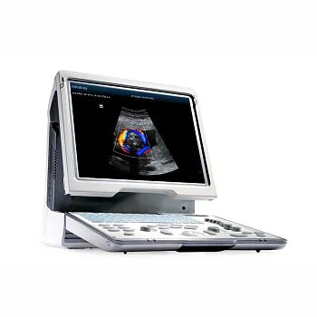 УЗИ аппарат Mindray DP-50 Color портативный