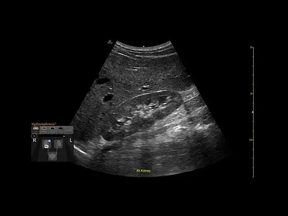 Клинические изображения GE HealthCare Venue Go УЗИ аппарат портативный