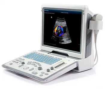 УЗИ аппарат Mindray DP-50 Color портативный