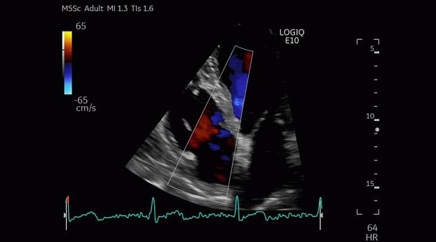 Клинические изображения GE HealthCare Logiq E10 ультразвуковая система
