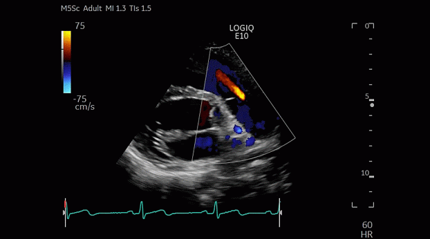 Клинические изображения GE HealthCare Logiq E10 ультразвуковая система